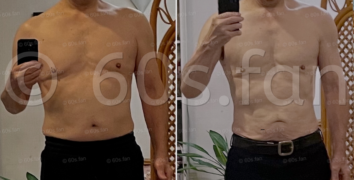 糖質制限で急激に体重が落ち、お腹にシワが寄った写真