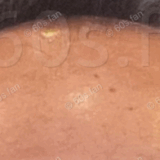 【鏡面解消】70代の頭皮を緩ませるマッサージ術—毛根に「居場所」を作る方法