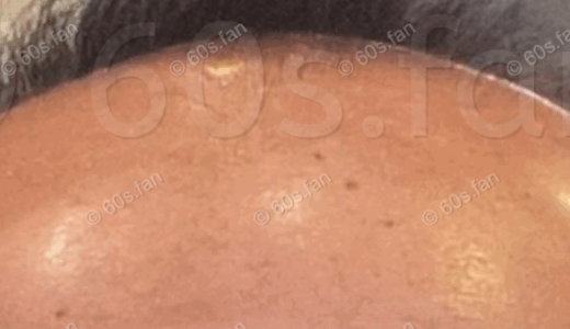 【鏡面解消】70代の頭皮を緩ませるマッサージ術—毛根に「居場所」を作る方法