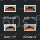 薄毛はもう遅い？何もしないまま時間が過ぎる理由｜70代の私が動けなかった本音