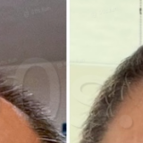 71歳の再起動｜漆黒の髪が物語る「肉体改造と発毛」の幸福な合流点