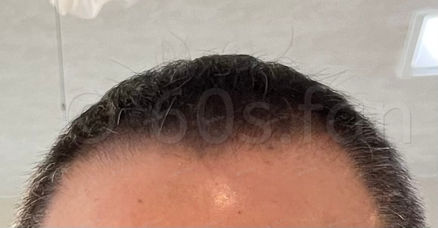 アフター１のコピー2