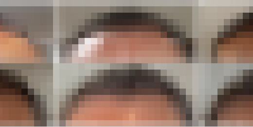 70代の薄毛対策｜21ヶ月の発毛経過写真を時系列で記録